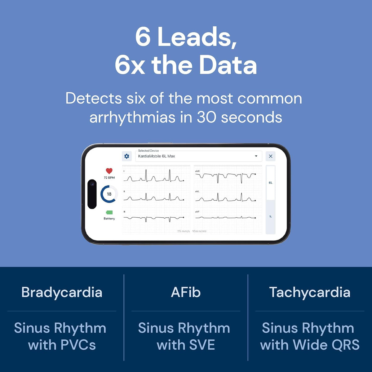 KardiaMobile 6L Max EKG Monitor, Includes One-Year KardiaCare Subscription, FDA-Cleared Heart Monitor, Medical-Grade Results in 30 Seconds, Unlimited Recordings, Works with Smartphones and Tablets
